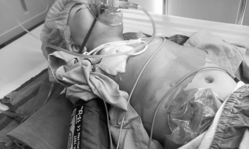 Cơ hội sống duy nhất của cậu bé bị đột biến gene